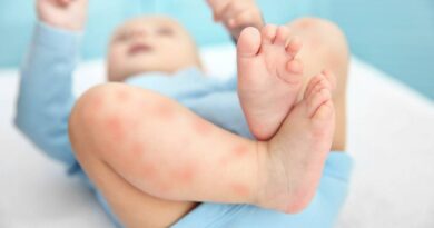Các bệnh da liễu thường gặp ở trẻ nhỏ