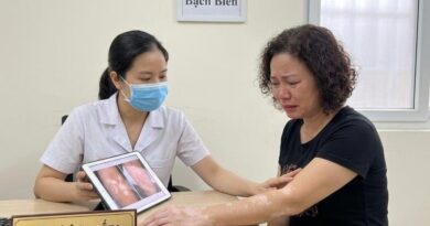 5 Phương Pháp Điều Trị Bệnh Bạch Biến 2026