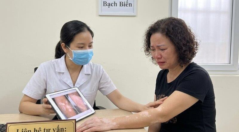5 Phương Pháp Điều Trị Bệnh Bạch Biến 2026 1 huong dan dieu tri benh bach bien vitiligo 2