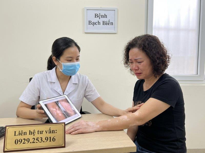 5 Phương Pháp Điều Trị Bệnh Bạch Biến 2026 2 huong dan dieu tri benh bach bien vitiligo 2