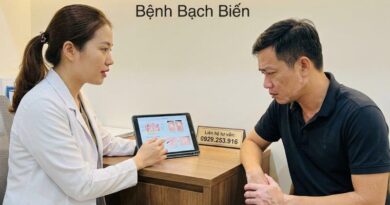 huong dan dieu tri benh bach bien vitiligo 4